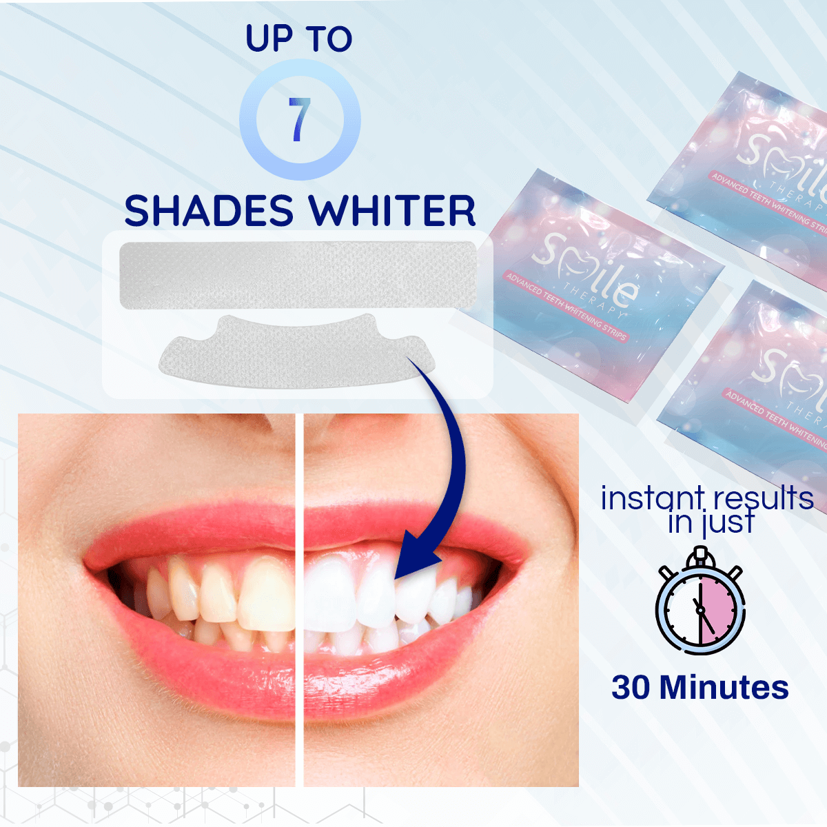 Advanced Teeth Whitening & Cleaning Strips (14 Treatments) DP3