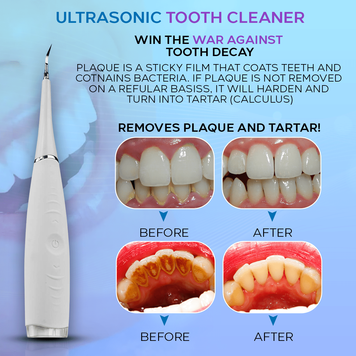 Ultrasonic Tooth Cleaner *BEST SELLER* DP6