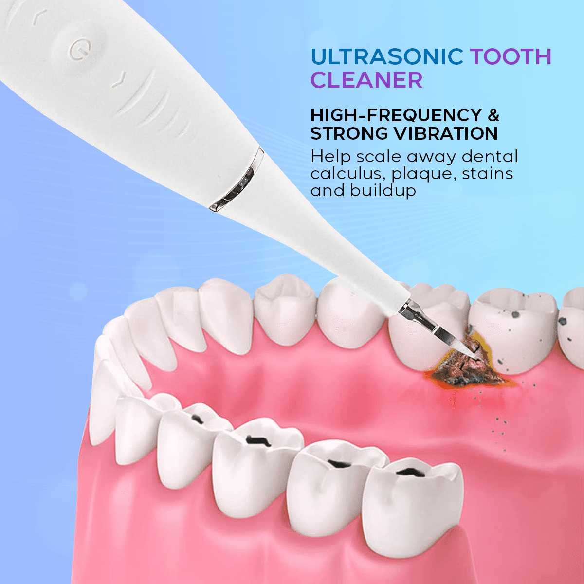 Ultrasonic Tooth Cleaner: High-Frequency Plaque Removal, Safe for Enamel, Rechargeable, Dental Care for Home Use DP7